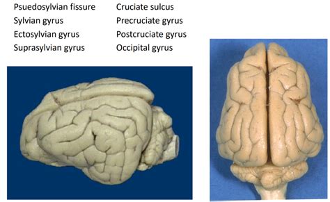 Cerebral Cortex Landmarks Diagram Quizlet