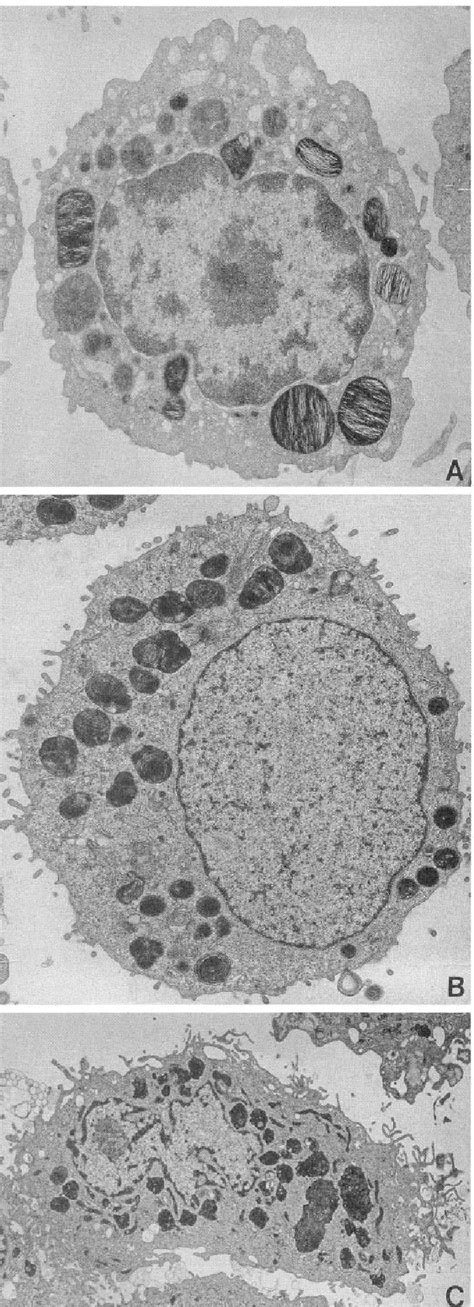 Table 1 From Isolation And Culture Of Alveolar Type II Cells