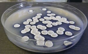 Streptomyces - ActinoBase