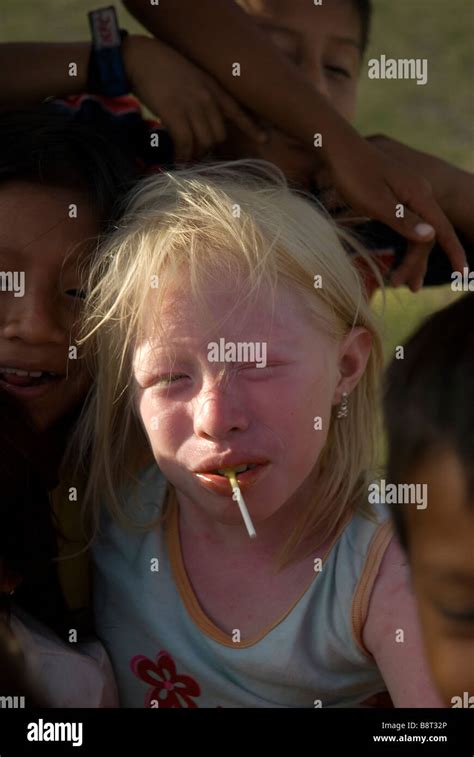 Albino children are known among the Kuna Indians as 'children of the ...