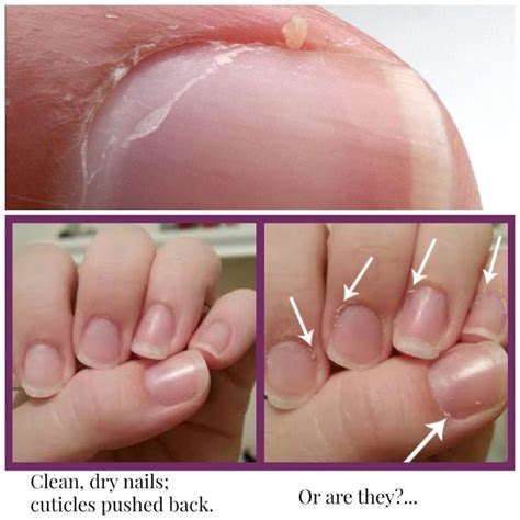 How To Remove Nails Cuticles Howtoremvo