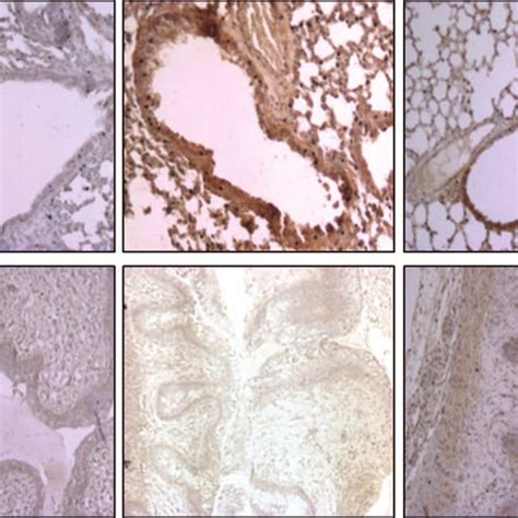 Hsv Antigens In Lung And Vagina Of Mice Intranasally Infected