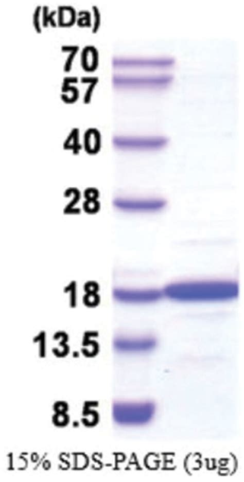 Novus Biologicals Nm23 H2nme2 Human Recombinant Protein 002mg