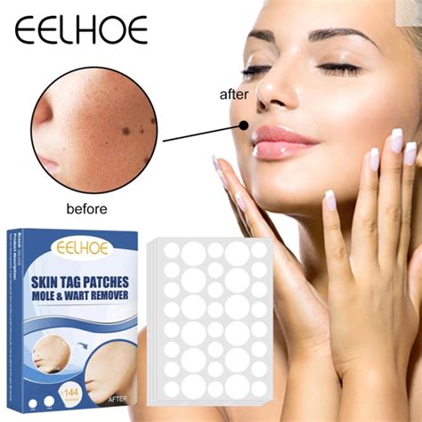 Jual Pcseelhoe Skin Tag Remover Patch Wart Removal Patch