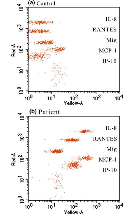 Representative Data For Cytometric Bead Array Chemokine From Controls Download Scientific