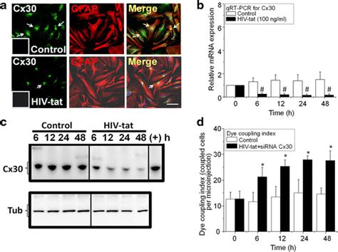 HIV Tat Did Not Increase Cx30 And MRNA Protein Expression And Did Not