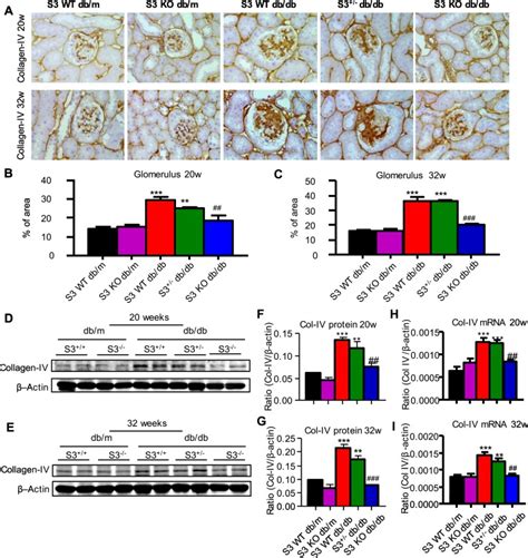 Deletion Of Smad Prevents Renal Fibrosis And Inflammation In Type