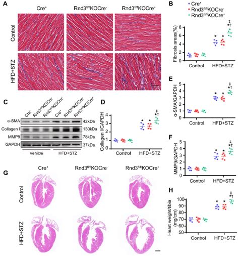 Fibroblast Specific Rnd Knockout Exacerbates Cardiac Fibrosis And