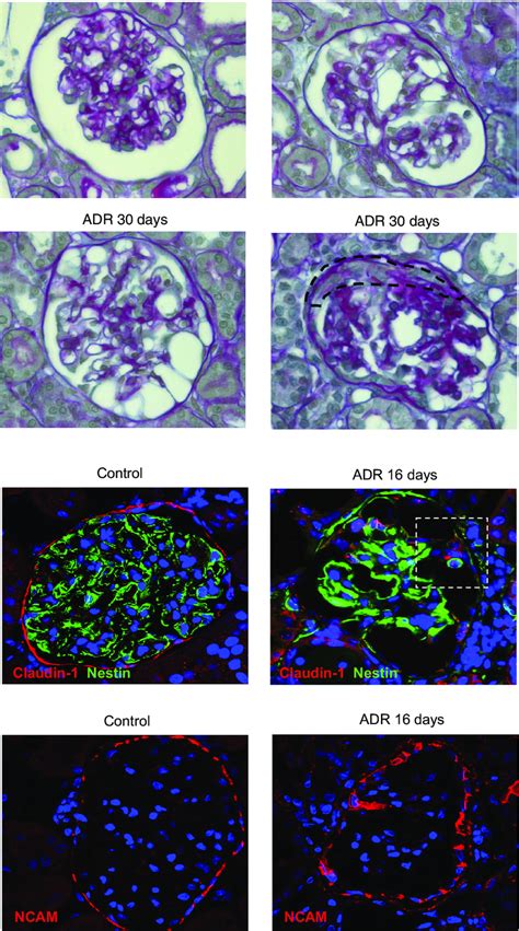 Glomerular Lesions In Rats With ADR Nephropathy At 16 And 30 Days A