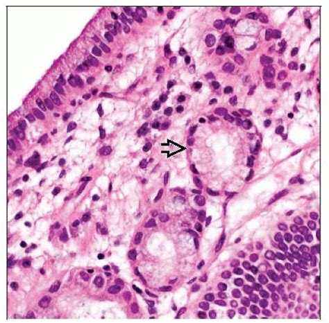 Pylorus Histology