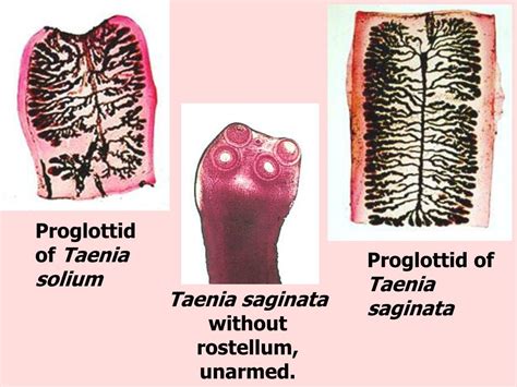 Ppt Cysticercosis And Echinococcosis Paul R Earl Facultad De Ciencias Biológicas Universidad