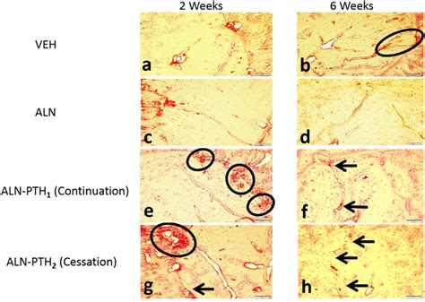 Ah Photomicrographs Showing Osteoclastic Activity In Different