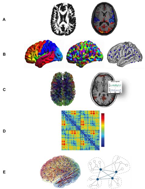 Steps For Generation Of Structural And Functional Brain Networks