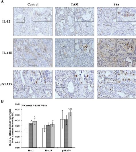 The Effects Of SSa On In Situ Expressions Of IL 12 IL 12R And