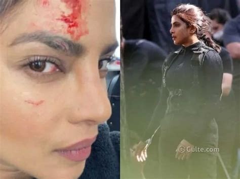 Priyanka Chopra Injured While Shooting Priyanka Chopra