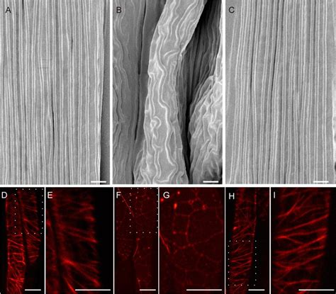 Mor1 1 Mutation Impaired Cortical Microtubule Organization In Filament