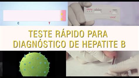 Teste R Pido Para O Diagn Stico Da Hepatite B Vikia Hbsag Youtube