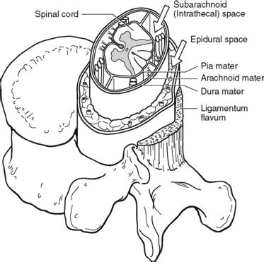 Intrathecal Vs Epidural Space