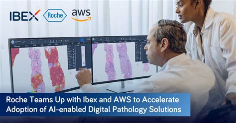 Roche Collaborates With Ibex And Amazon Web Services To Accelerate