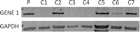 Crispr Knockout Confirmation Via Western Blot Analysis Download