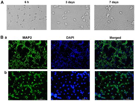 Ketamine Destabilizes Growth Of Dendritic Spines In Developing