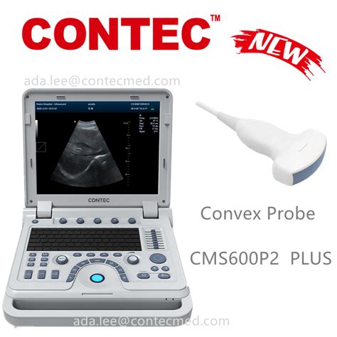 CONTEC B Ultrasound Diagnostic System PW Doppler Obstetrics And