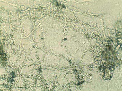 Powdery Mildew Fungi Phyllactinia Fraxini On Ash Fraxinus Excelsior