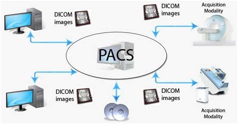 Qu Son Los Pacs Y C Mo Funcionan Haras Dadinco