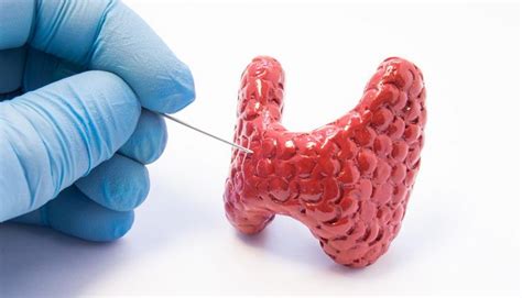 What is a biopsy?