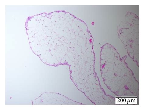 Histopathological Photomicrographs Hematoxylin And Eosin Stained