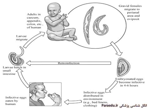 سیر تکاملی انتروبیوس ورمیکولاریس Enterobius Vermicularis Life Cycle 11616 Hot Sex Picture