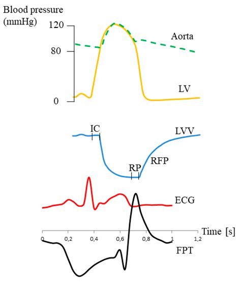 Jcm Free Full Text Pleural Pressure Pulse In Patients With Pleural