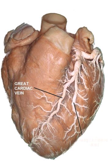 CARDIAC VEINS - CThSurgery.com