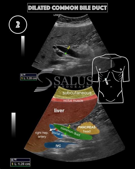 Ultrasound Education On Instagram “ ️answer To Last Post👨‍💻 ⚜