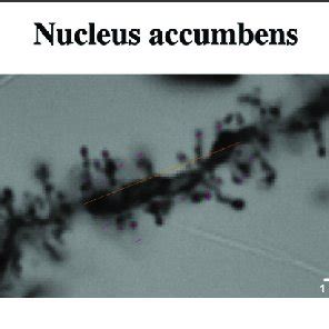 One Representative Dendrite Section From The Hippocampus Nucleus