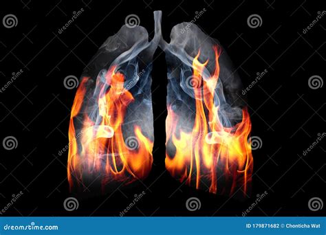 Smoker`s Lungs. Damage To The Lungs Of A Person Caused By Smoking. Cartoon Vector ...