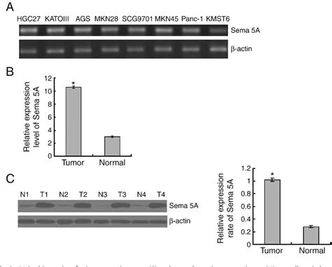 Semaphorin Plexin Signaling Pathway Involved In Axon Guidance