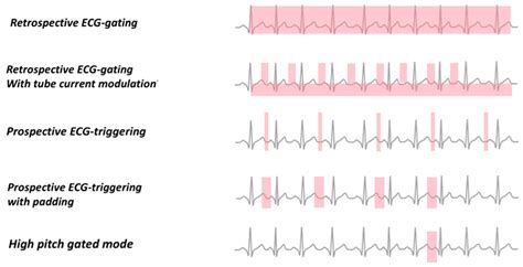 Smaller devices will lead the hybrid ct future soon 18
