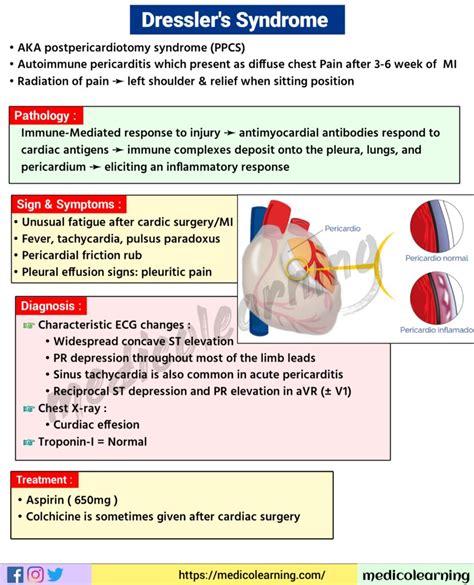 Dressler syndrome – MedicoLearning