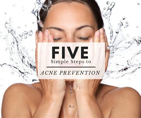 5 Simple Steps to Acne Prevention - Beauty Bedazzled