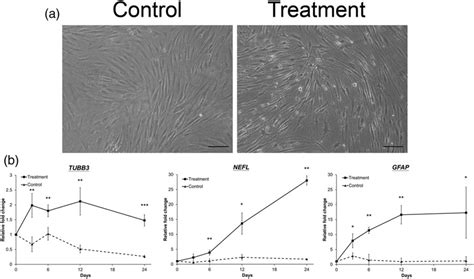 Neural Differentiation Of Human Neural Crest Stem Cells Ncscs And