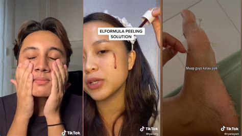 Tiktok Viral Racun Berfaedah Tiktok Skincare Check Indonesia Shopee