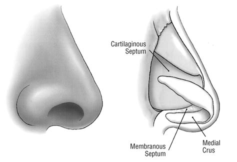 The Tongue In Groove Technique In Septorhinoplasty A 10 Year