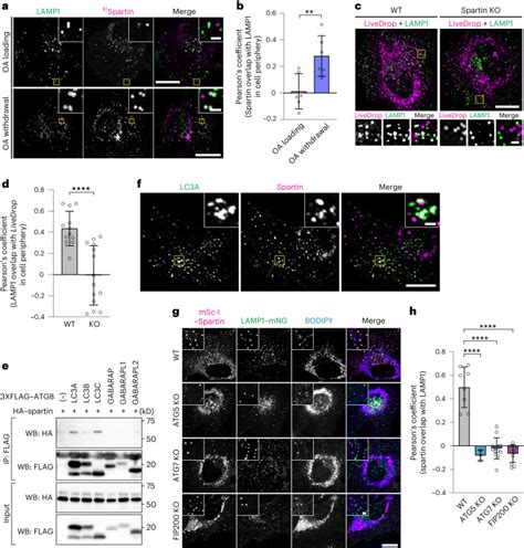 The Troyer Syndrome Protein Spartin Mediates Selective Autophagy Of