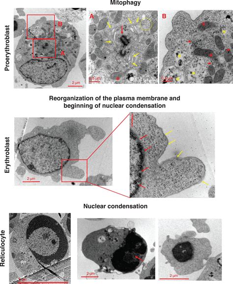 Biology Of Erythropoiesis Erythroid Differentiation And Maturation