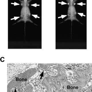 Mineralized tumors formed by SaOS 2 Gsα 2 cells SaOS 2 Gsα 2 cells