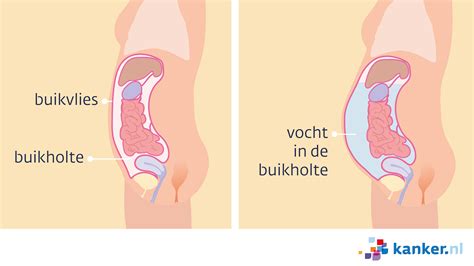 Olakšajte poklopac rođen ik heb er mijn buik van vol betekenis Izvući