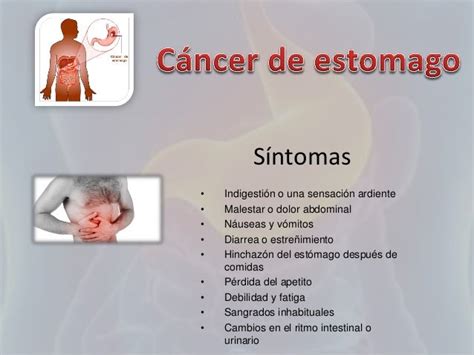 Cancer De Intestino Sintomas