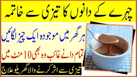 Chehre Ke Dano Ka Ilaj For Remove Pimples Natural Acne Treatment