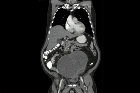 Tomografia Abdominal Aposte nas dezenas do jacaré e tenha uma nova